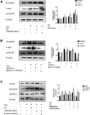 TMEM88 Modulates Lipid Synthesis and Metabolism Cytokine by Regulating Wnt/β-Catenin Signaling Pathway in Non-Alcoholic Fatty Liver Disease